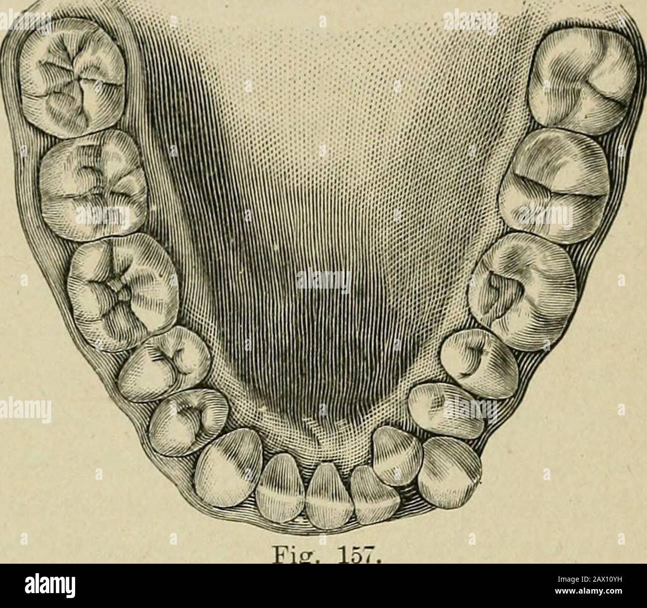 The etiology of osseous deformities of the head, face, jaws and teeth