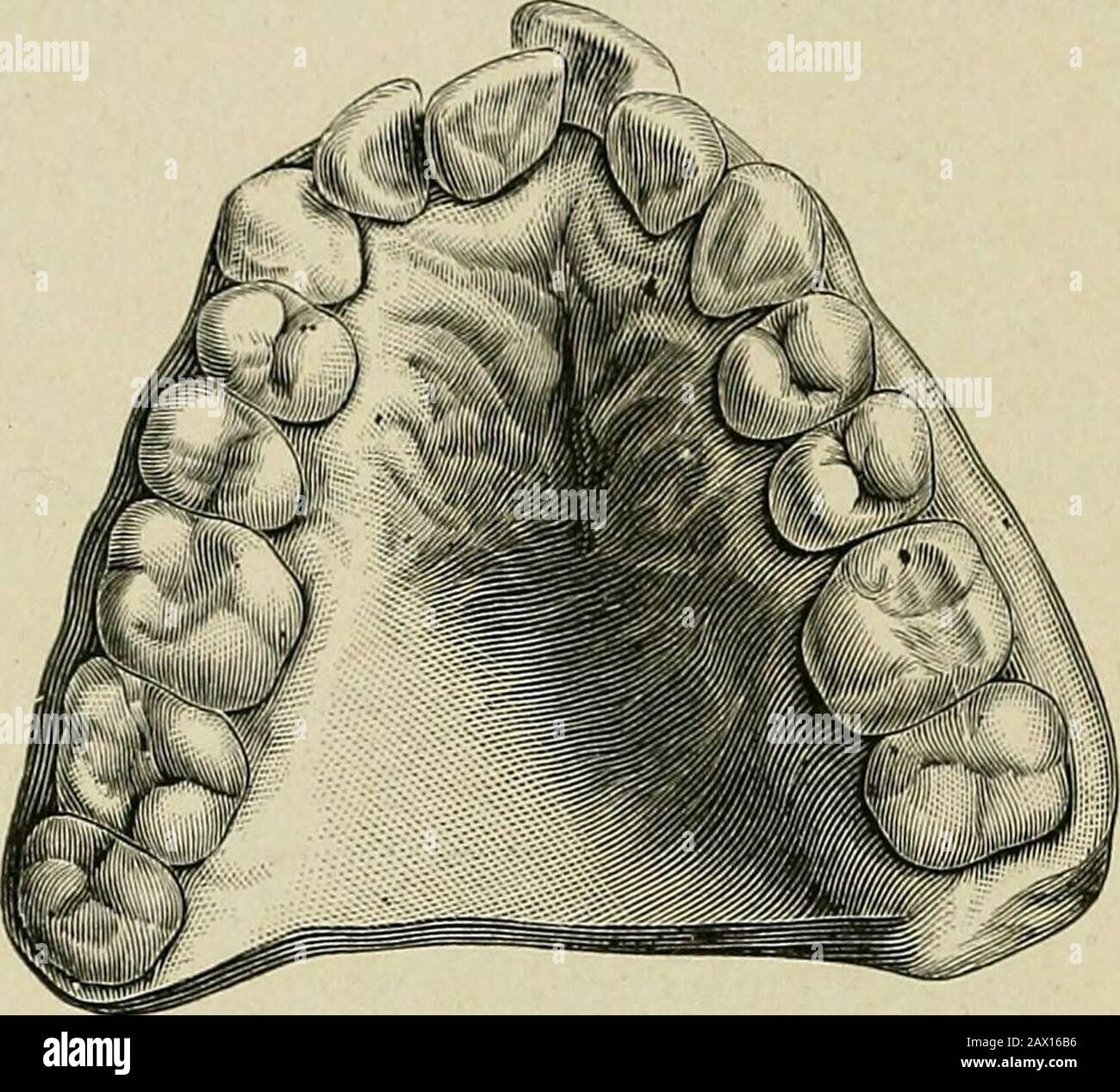 The etiology of osseous deformities of the head, face, jaws and teeth