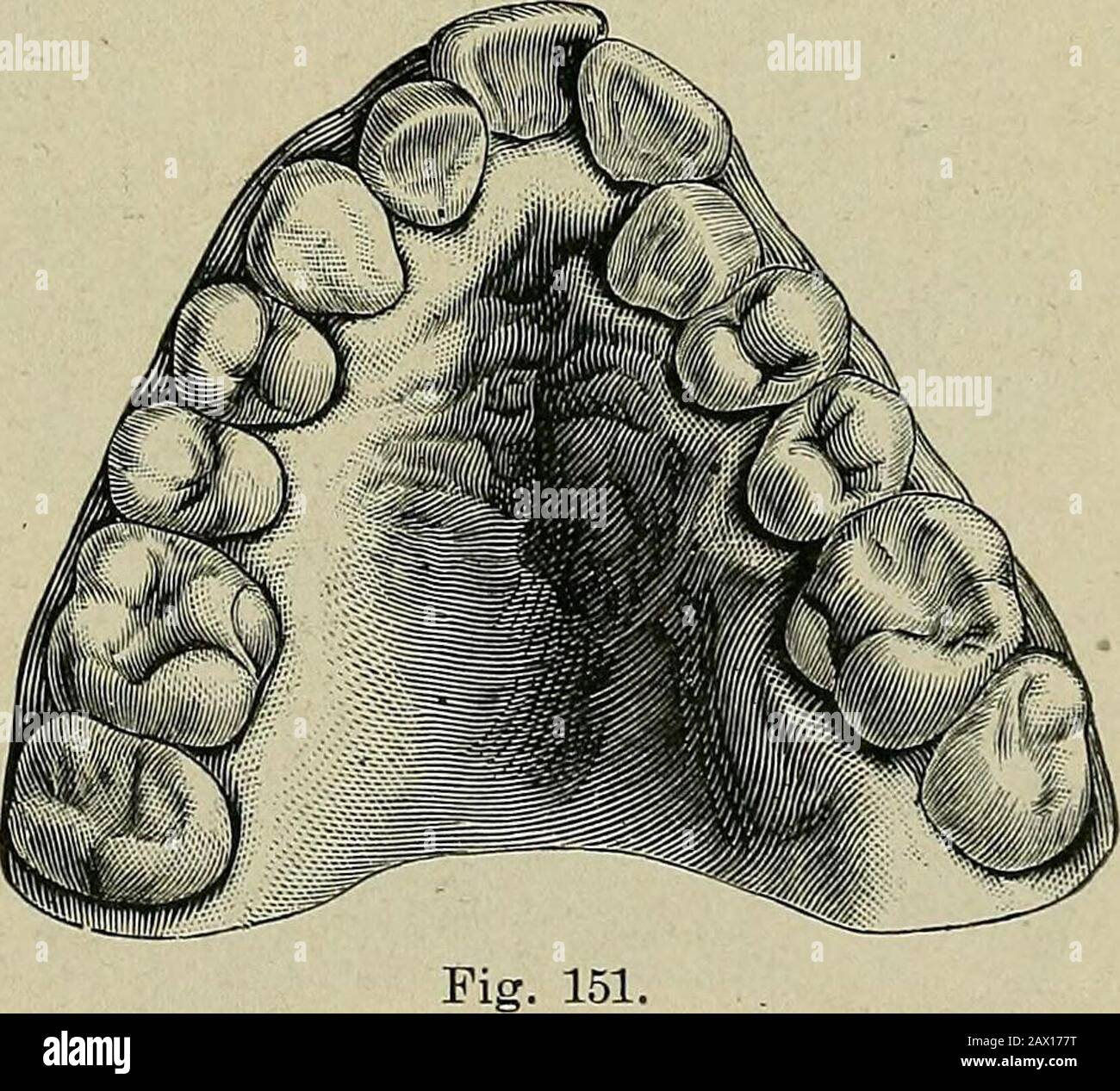 Automorphic Cuspidal The etiology of osseous deformities of the head, face, jaws and teeth ...
