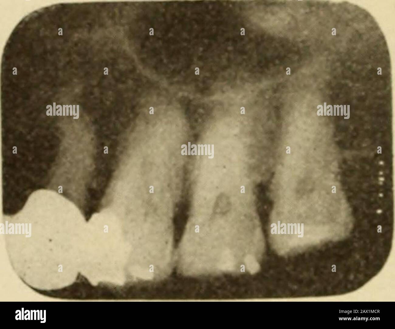 Diseases of the soft structures of the teeth and their treatment; a ...