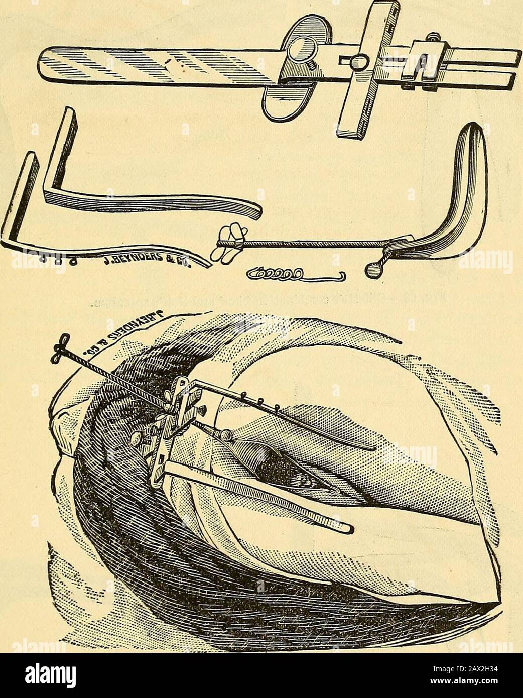 Minor surgical gynecology a manual of uterine diagnosis and the