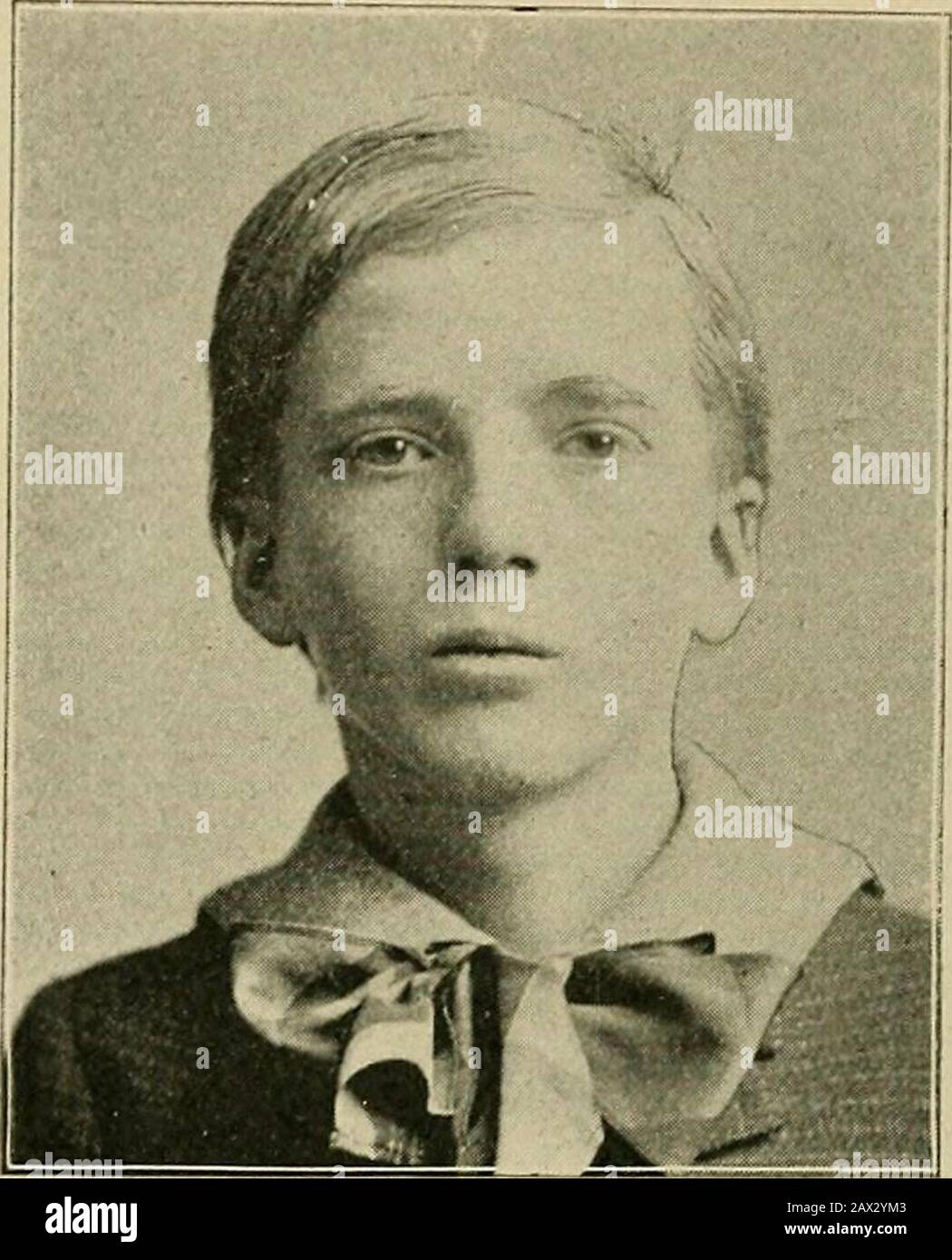Macrocephalic hi-res stock photography and images - Alamy