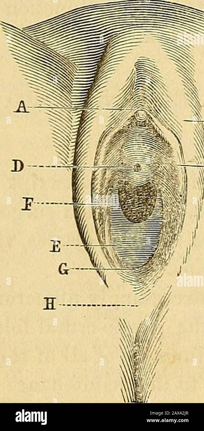 hymen child Assessments of Girls' Genital Findings and the Likelihood of Sexual Abuse
