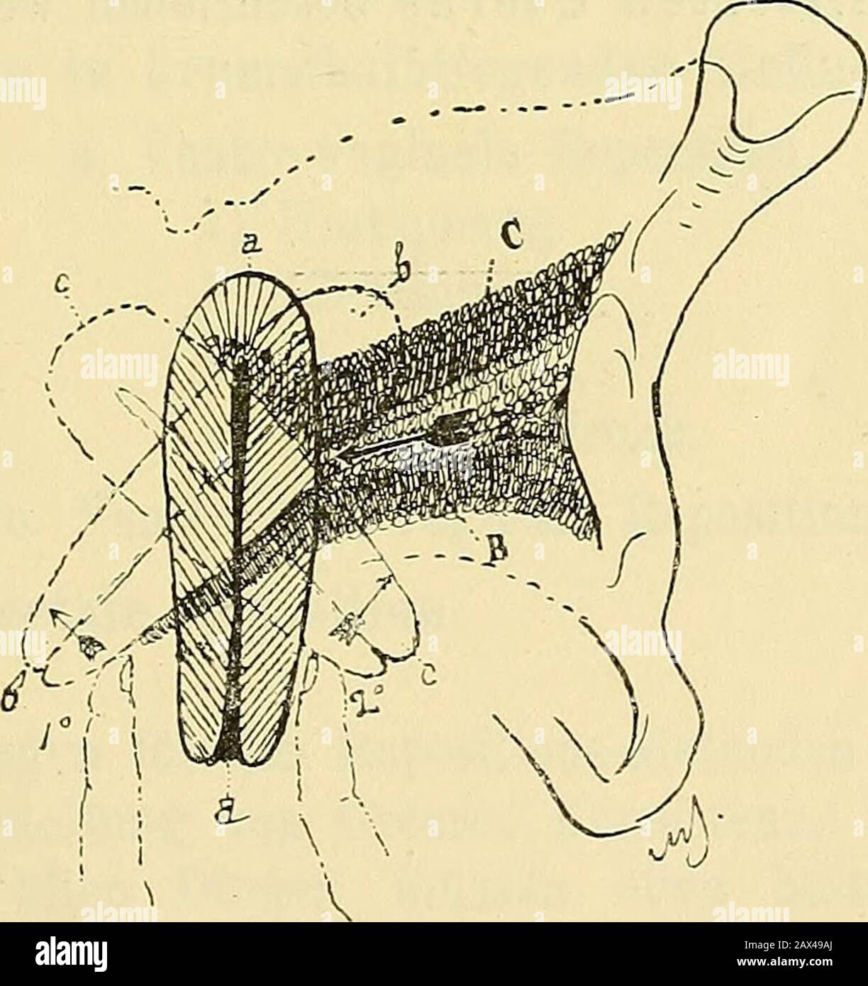 Die Heilgymnastik In Der Gynaekologie Und Die Mechanische Behandlung Von Erkrankungen Des Uterus Und Seiner Adnexe Nach Thure Brandt Sstrang Moglichst Zu Dehnen Dehnung Von Adharenzen 81 In Diesem Augenblick