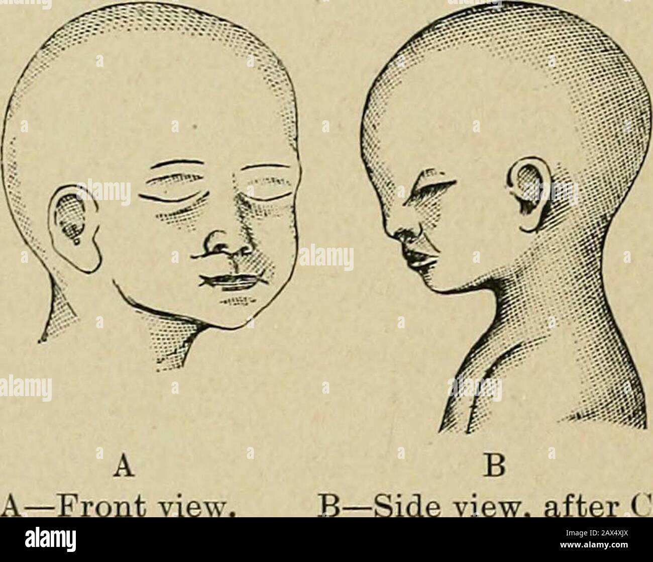 The Etiology Of Osseous Deformities Of The Head Face Jaws And