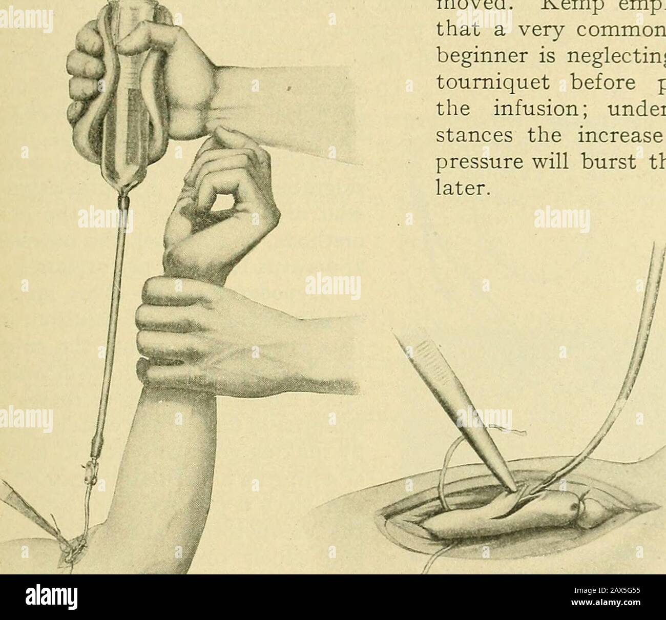 Ligature point hires stock photography and images Alamy