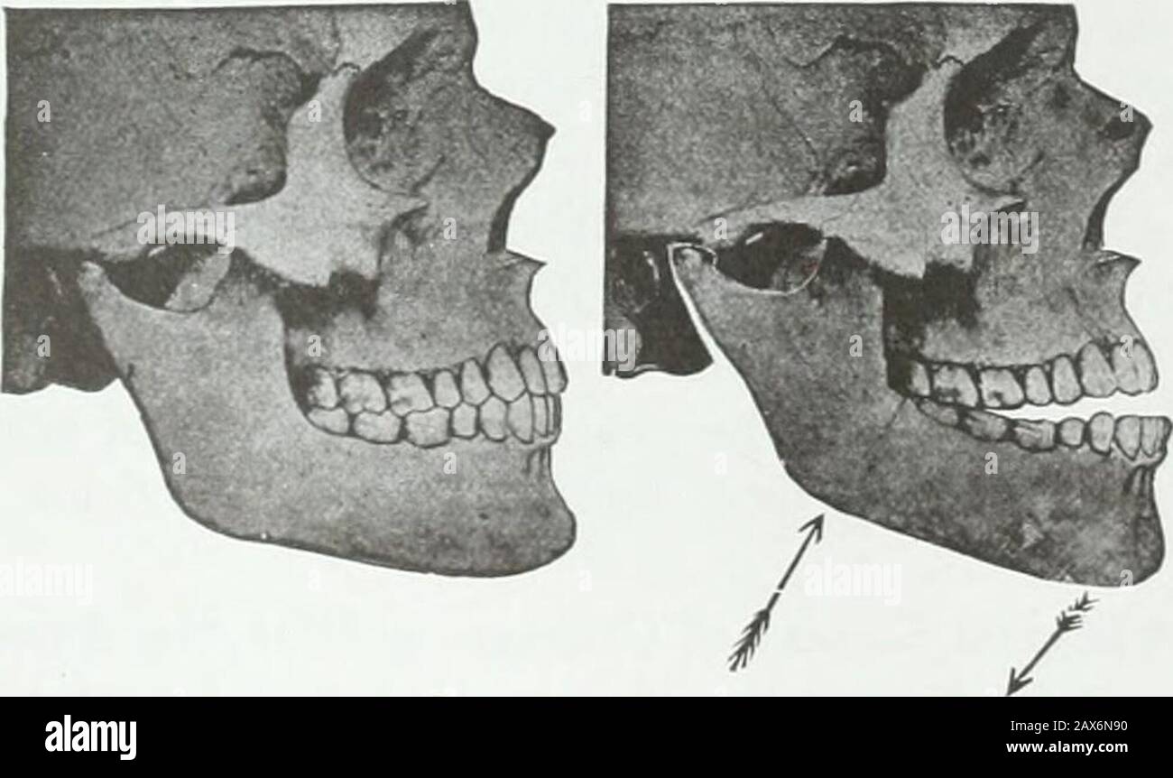 A practical treatise on the technics and principles of dental