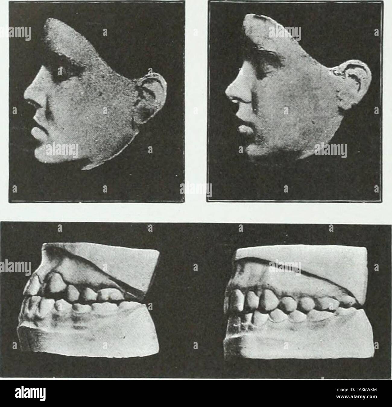A practical treatise on the technics and principles of dental