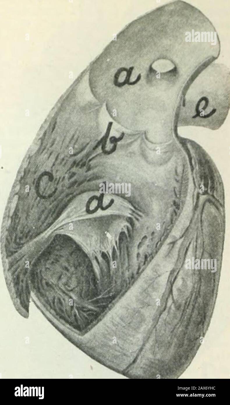 Tietosanakirja . e n (sinus &lt; 1 nosusj,joka alemmilla selkärankaisilla on selvästi etei-sistä erillään, mutta linnuilla ja imettäväisillätäydellisesti sulanut oikeanpuoleiseen eteiseen.Alemmilla kaloilla (haikaloilla ja kiillesuomui-silla) on s.-kammion oraalipuolella tämän jakiduksiin vievän kidu s aortan (truncus urte-riosus) välillä kekomainen laajennus, valtimo-keko (conus arteriosus), jonka sisäpinnalla onuseita taskumaisia läppiä monessa rivissä. Val-timokeko, joka on kammiosta erilaistunut osa,surkastuu luukaloilla ainoastaan kahdella läpällävarustetuksi, ulkoapäin näkymättömäksi osa Stock Photo