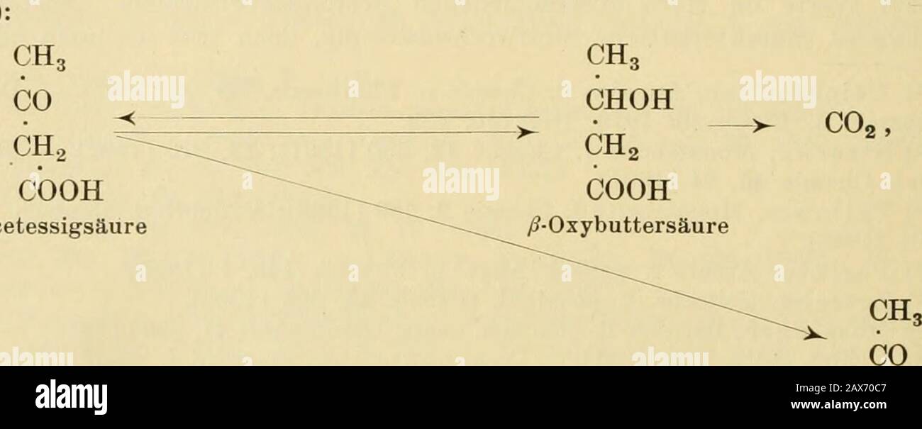 Biochemisches Handlexikon . cetonurieii); Scharlach-Acetonurie 12); Acetonurie nach Chloroform- oder Äther-anästhesiei3). Zusammenhang der Acetonkörper (1 -/? - Oxybuttersäure, Acetessigsäure,Aceton)!*): Im tierischen Organismus entsteht aus/9-Oxybuttersäure durch Oxydation Acetessig-säure und aus dieser unter COg-Abspaltung Aceton: CH3CH(OH)CH2COOH + O = (CH3CO)CH2COOH + H2O = CH3COCH3 + CO2 1^). Der Organismus ist jedoch auch imstande durchReduktion aus Acetessigsäure l-/?-Oxybuttersäure zu bilden iß); überlebende Leber (Hund)vermag gleichfalls diese Reduktion auszuführen (Blum, Dakin, Wakem Stock Photo