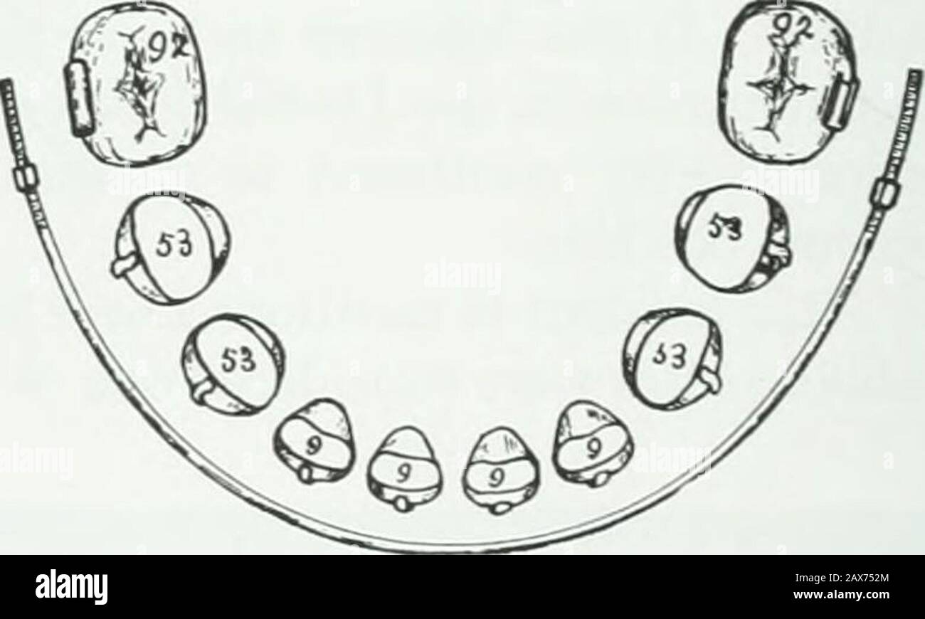 A practical treatise on the technics and principles of dental