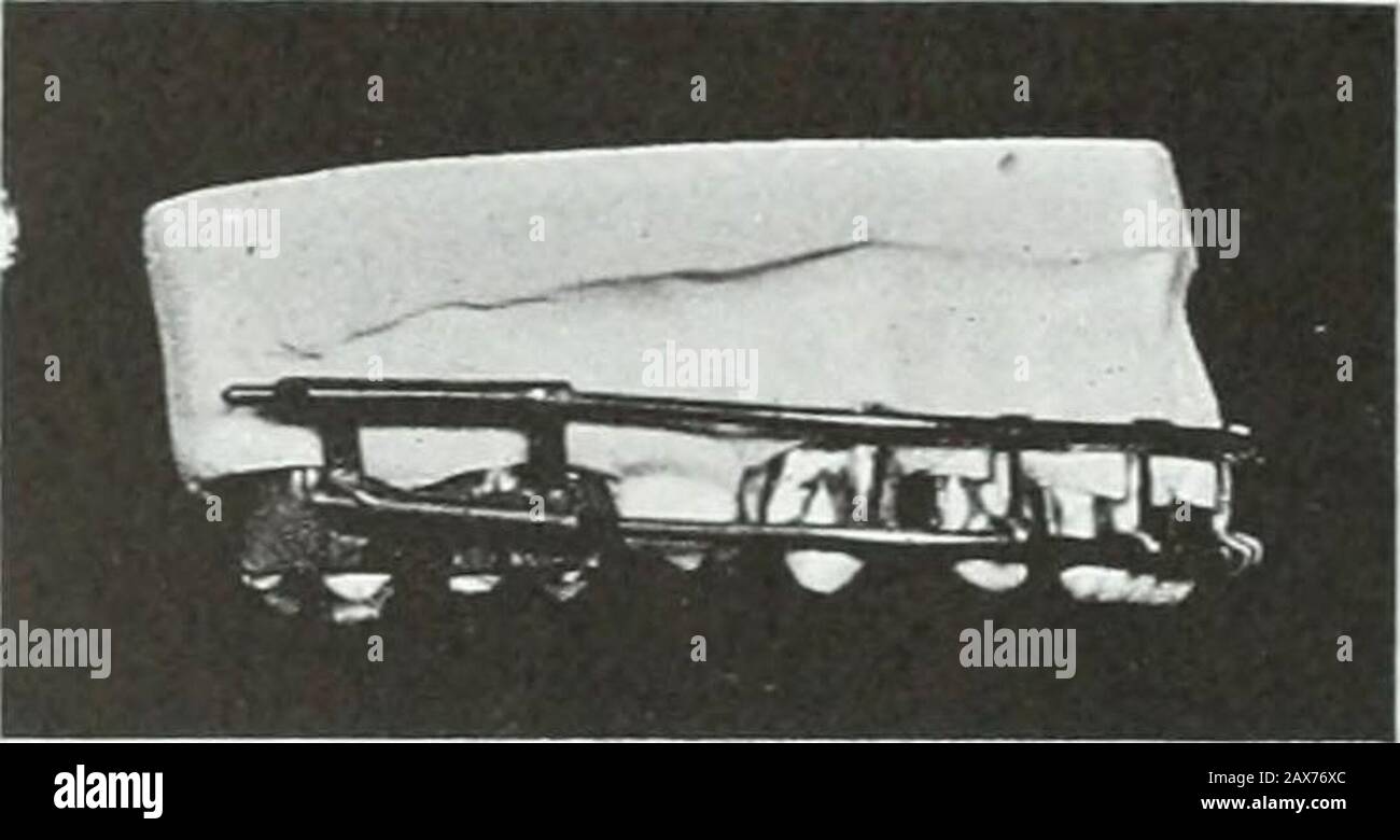 A practical treatise on the technics and principles of dental