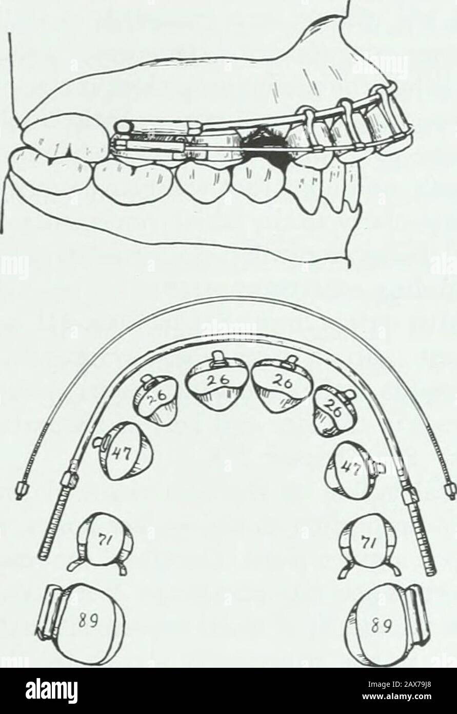 A practical treatise on the technics and principles of dental