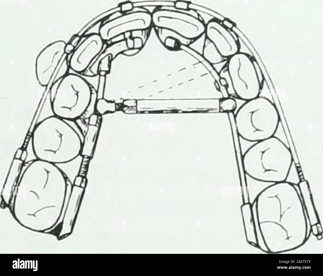 A practical treatise on the technics and principles of dental