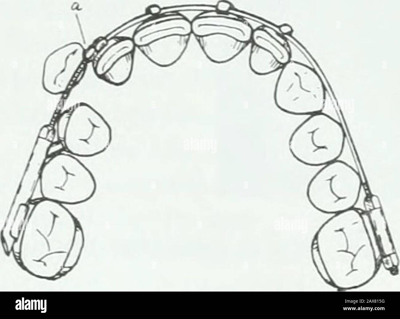 A practical treatise on the technics and principles of dental