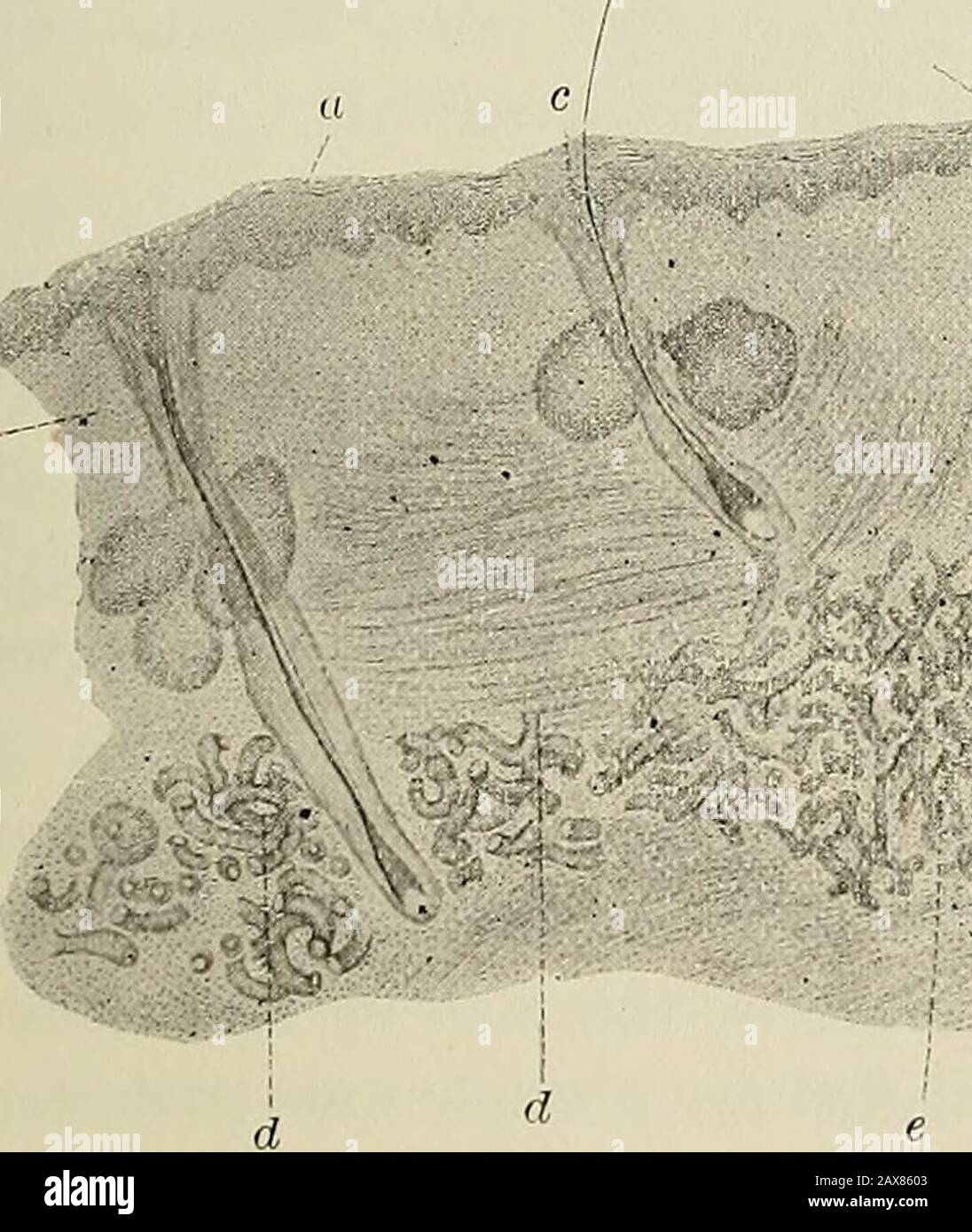 The pathology and surgical treatment of tumors . Fig. 153.—Vertical