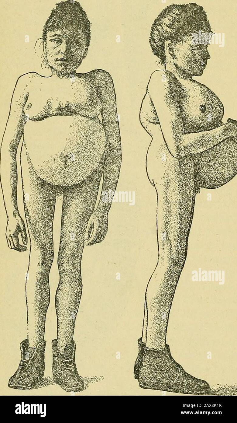 The practice of obstetrics, designed for the use of students and