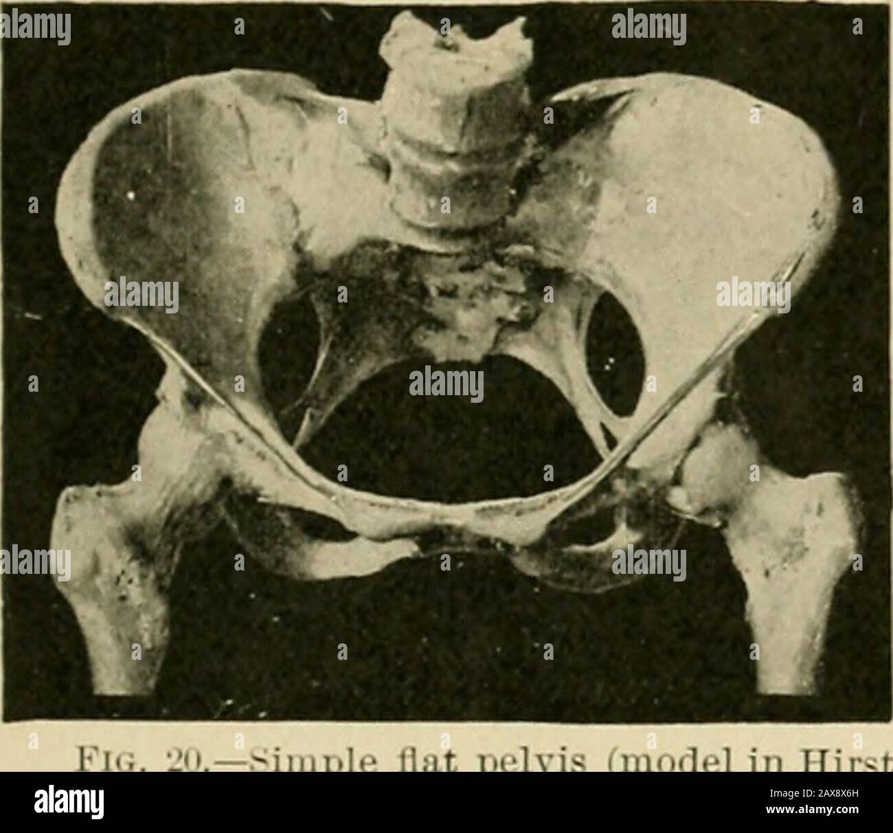 Dystocia Hi Res Stock Photography And Images Alamy