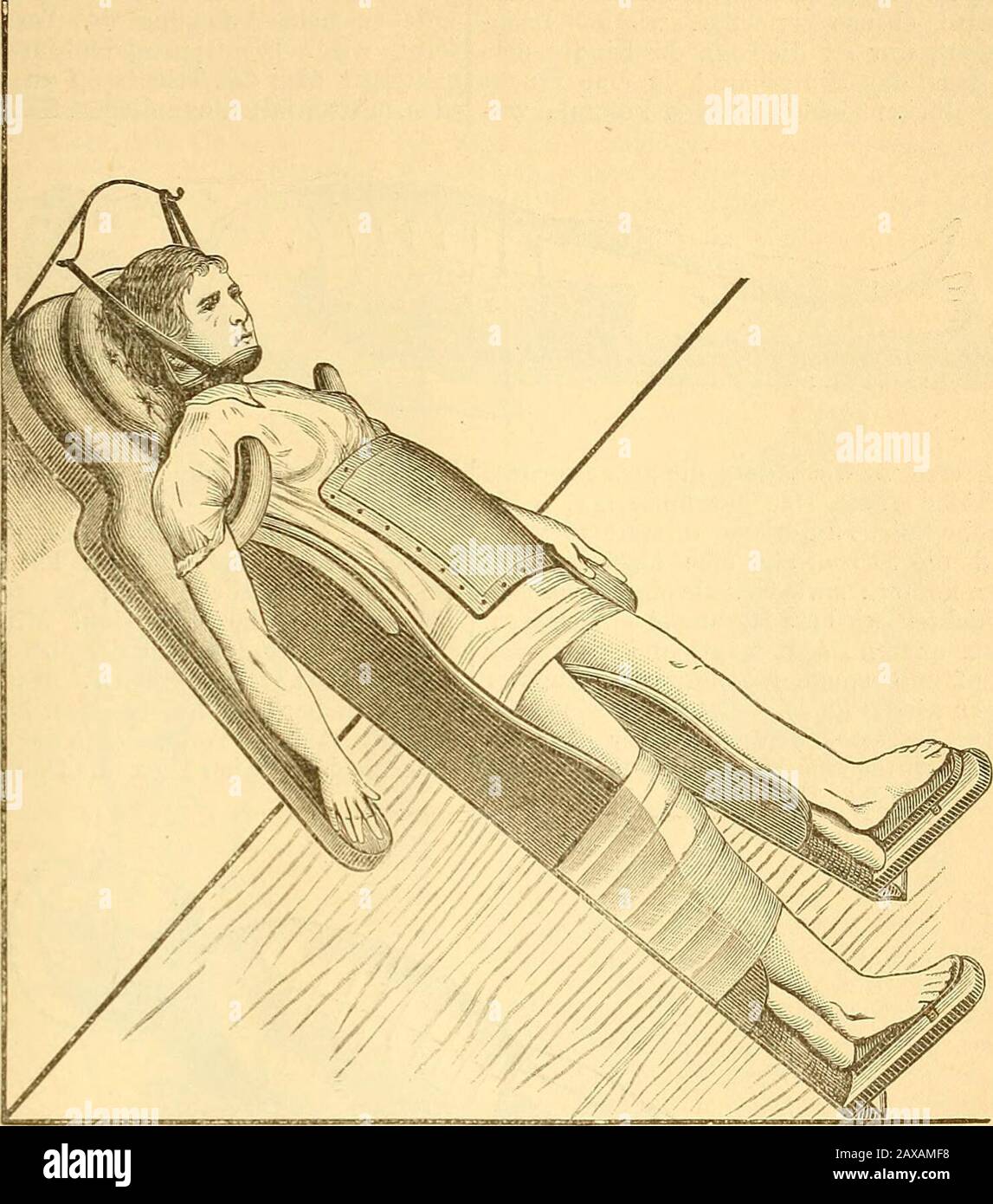 Therapeutisches Lexikon : für praktische Ärzte . t unter dieSchulter undunter dieOberschenkel des inBauch-lage befindlichen Kindes gepolsterte Rollkissen(Fig. 2); dadurch sinkt der mittlere Theil derWirbelsäule lordotisch ein. Durch Verwendungvon dünneren und dickeren Rollkissen kannder Grad der so erzielten Reclination dosirtwerden. Zu starke Reclination ist wegen derdamit verbundenen Zerrung der Wirbelkörperschmerzhaft und soll vermieden werden. Istdie richtige Lage gefunden, d. i. derjenigeGrad von Reclination, in denen die Kinderden geringsten Schmerz empfinden, so wird,während der Kopf fi Stock Photo