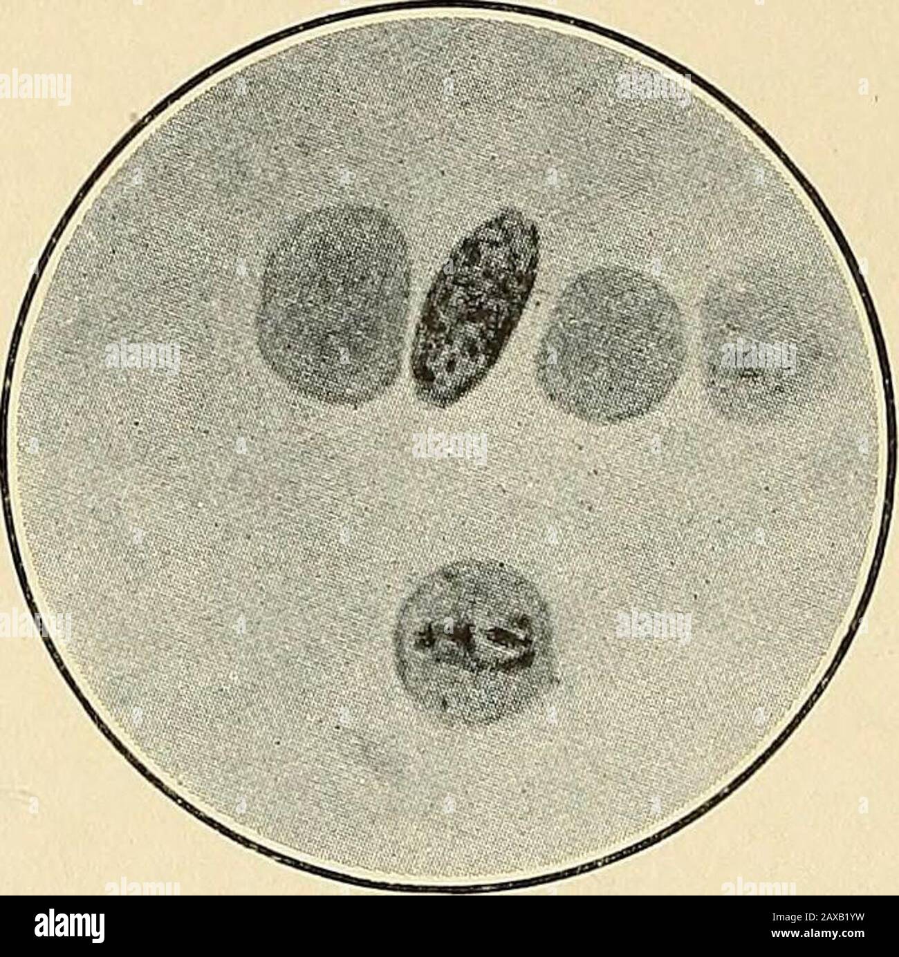 The malarial fevers, haemoglobinuric fever and the blood protozoa of man . val and later round in form, after which4 50 THE ETIOLOGY OF THE MALARIAL FEVERS. the microgametes or flagella are developed as in the other malarial plasmodia(see Fig. lo). Fresh Preparations.—The crescentic gametes of the aestivo-autumnalPlasmodia are developed within the red corpuscles and during their intra-corpuscular stage are distinguished from the schizonts by their limited amoeboidmotion, the early development of a greater amount of pigment within them,the crescentic or ovoid form acquired during the latter sta Stock Photo