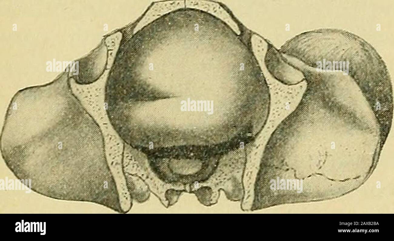 Birth With Forceps High Resolution Stock Photography and Images Alamy
