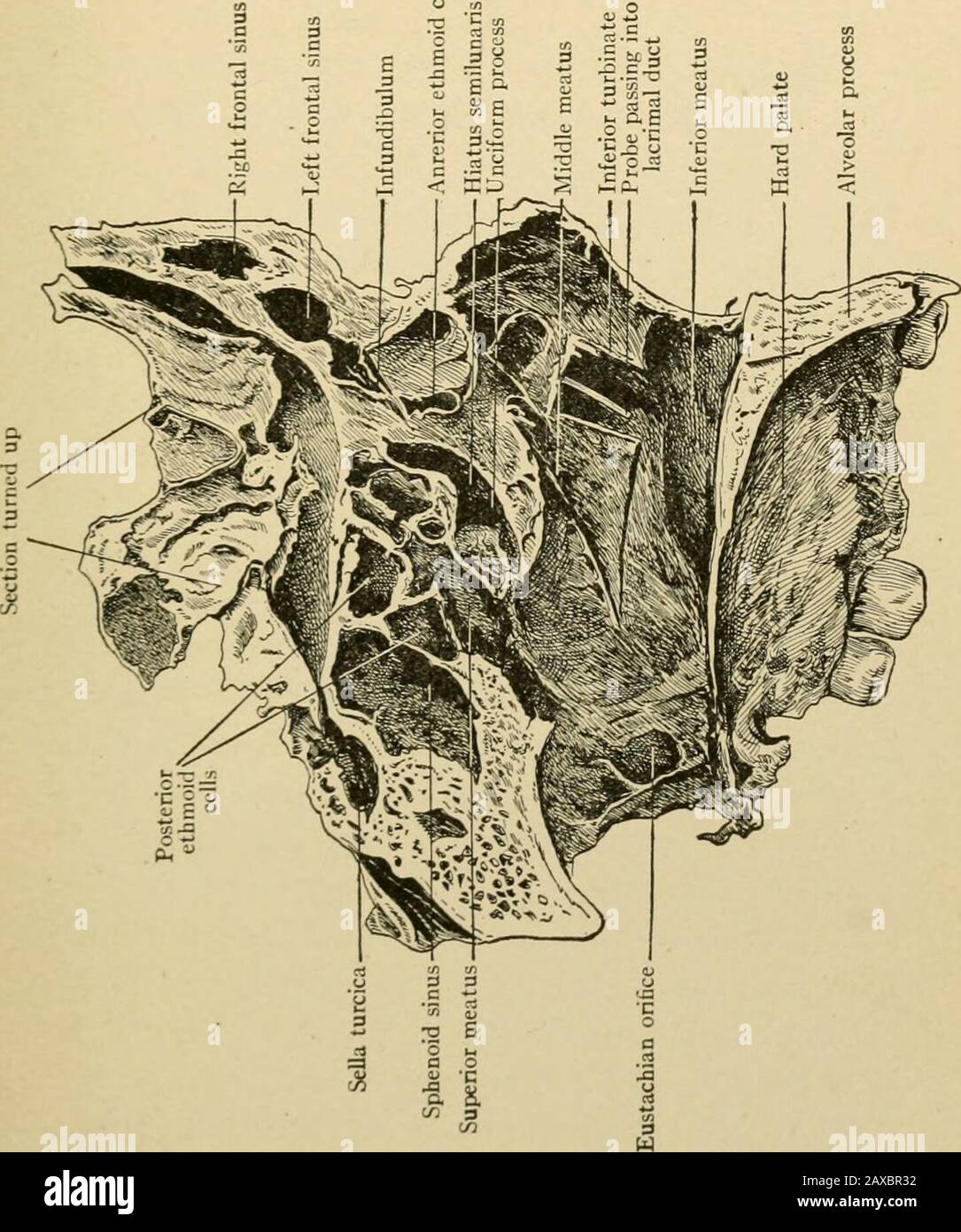 Applied anatomy and oral surgery for dental students . n, the crests of the maxillary and palate bones, therostrum of the sphenoid, and the nasal spine of thefrontal bones assist in forming the nasal septum (Fig. 8). The bones entering into the formation of the lateralwall of the nasal chamber are: the nasal, the nasal processof the maxillary, the lacrimal, the ethmoid, the inferiorturbinated, the palate, and the pterygoid process andbody of the sphenoid. The inferior turbinated bone and the turbinatedprocesses of the ethmoid bone divide the lateral wall ofthe nasal chamber into several horizo Stock Photo