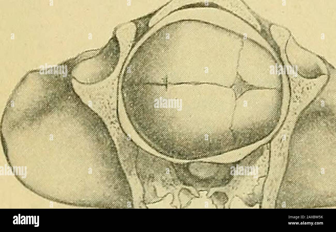 The practice of obstetrics, designed for the use of students and practitioners of medicine . I i Fig. 644.—Bregma at the Pelvic Inlet.. Fig. 645.—Bregma at the Pelvic Inlet. Stock Photo