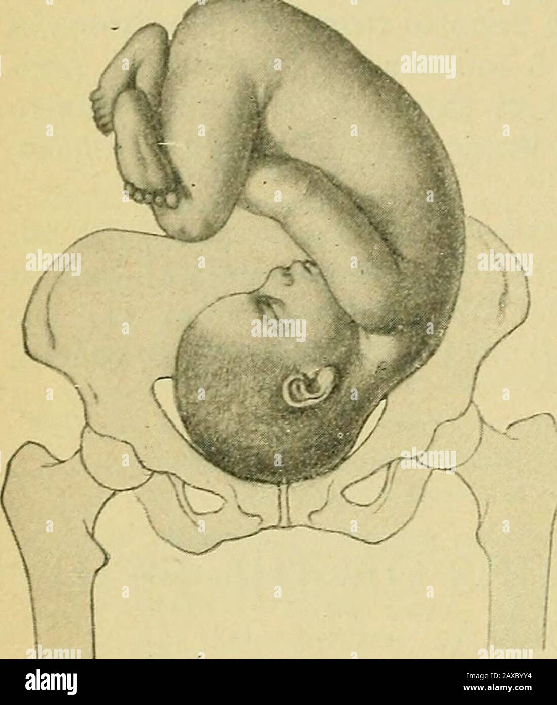 The practice of obstetrics, designed for the use of students and  practitioners of medicine . nsverse axis, midway between flexion and  extension, thebrow or the region immediately in front of the bregma