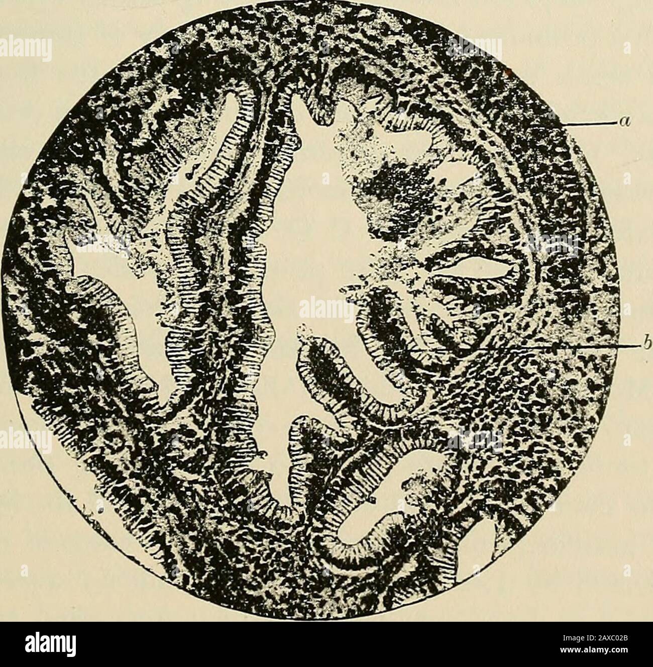 The pathology and surgical treatment of tumors . ^ e d Fig. 27