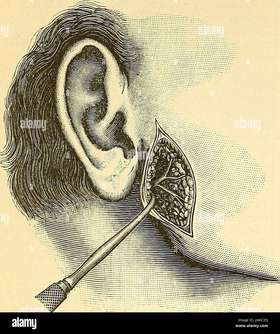 Therapeutisches Lexikon Fur Praktische Arzte Des Herzens Dann