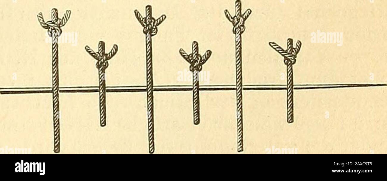 Therapeutisches Lexikon : für praktische Ärzte . Nicht selten — zumal bei bereits .inficirtenWunden und dort, wo man befürchten muss,dass Blutverhaltung hinter der N. erfolgt —ist die N. mit der Drainage (s.d.) zu verbinden,indem man zwischen die Nähte eine oder Fig. 9.. mehrere Drainröhren in die Nahtlinie einlegt,dieselben eventuell durch die Drainröhre mit-fassende Knopfnähte befestigend, oder indemman den unteren Wundwindel offen lässt undin denselben ein Drainrohr, ein aus Gummi-papier gedrehtes Röllchen oder nur einen Cat-gutfaden einlegt. Soll der ganze Grund deroberflächlich vernähten Stock Photo