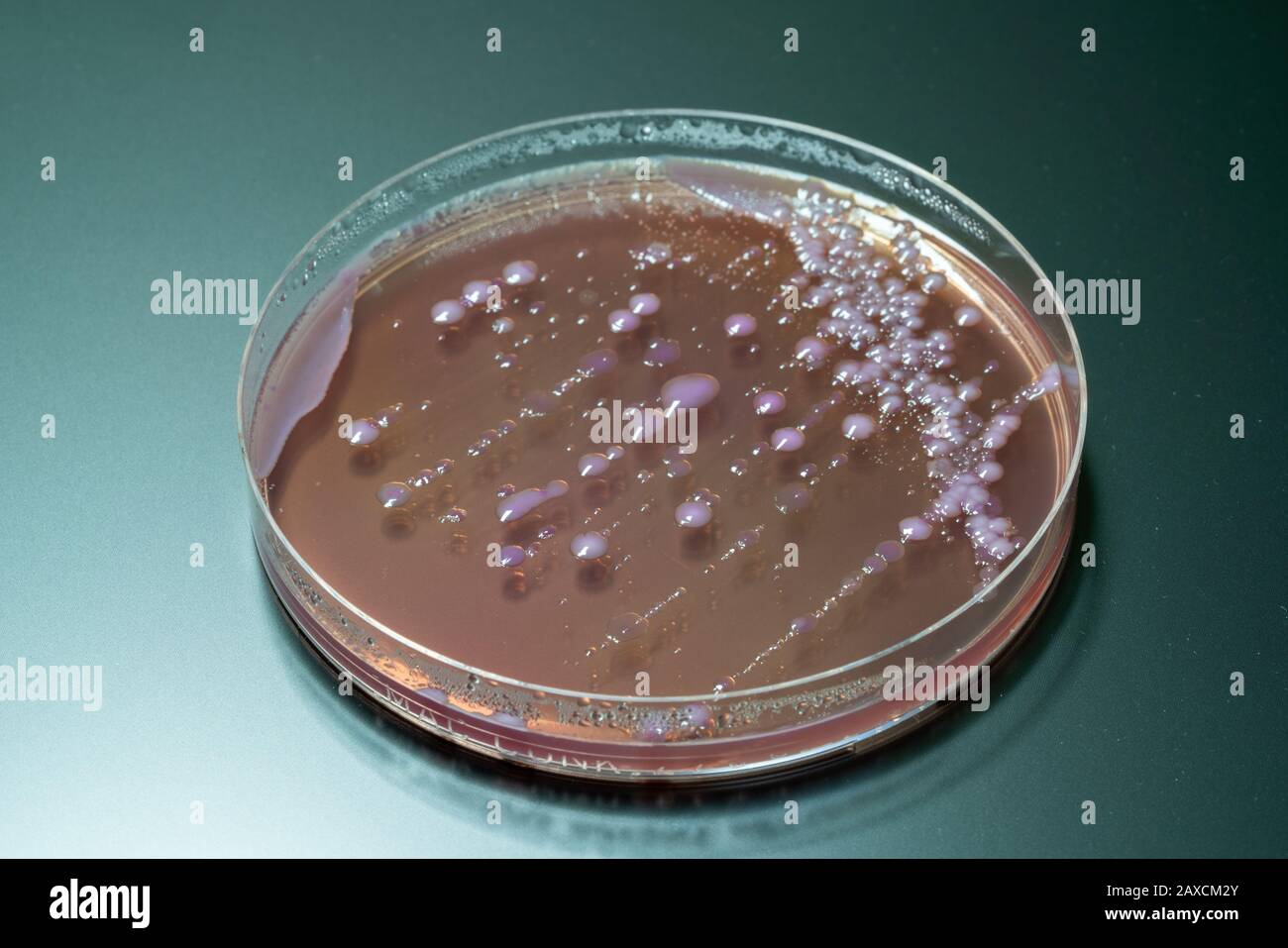 bacterial colonies on agar medium petri dish plate plate with MacConkey