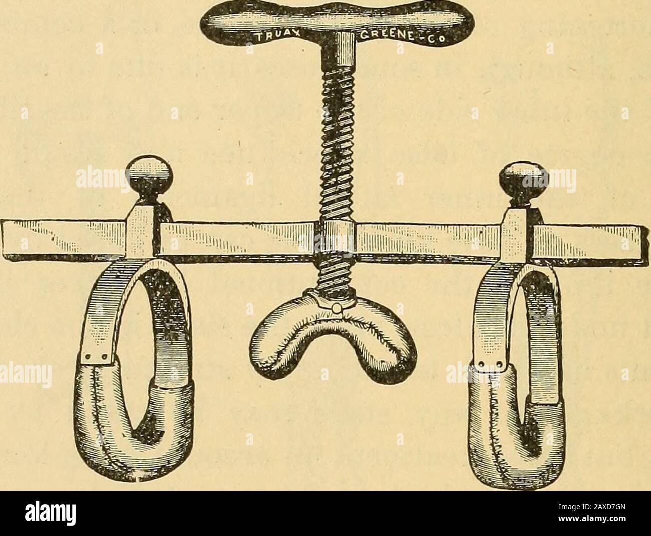 Leg lengthening operation hires stock photography and images Alamy