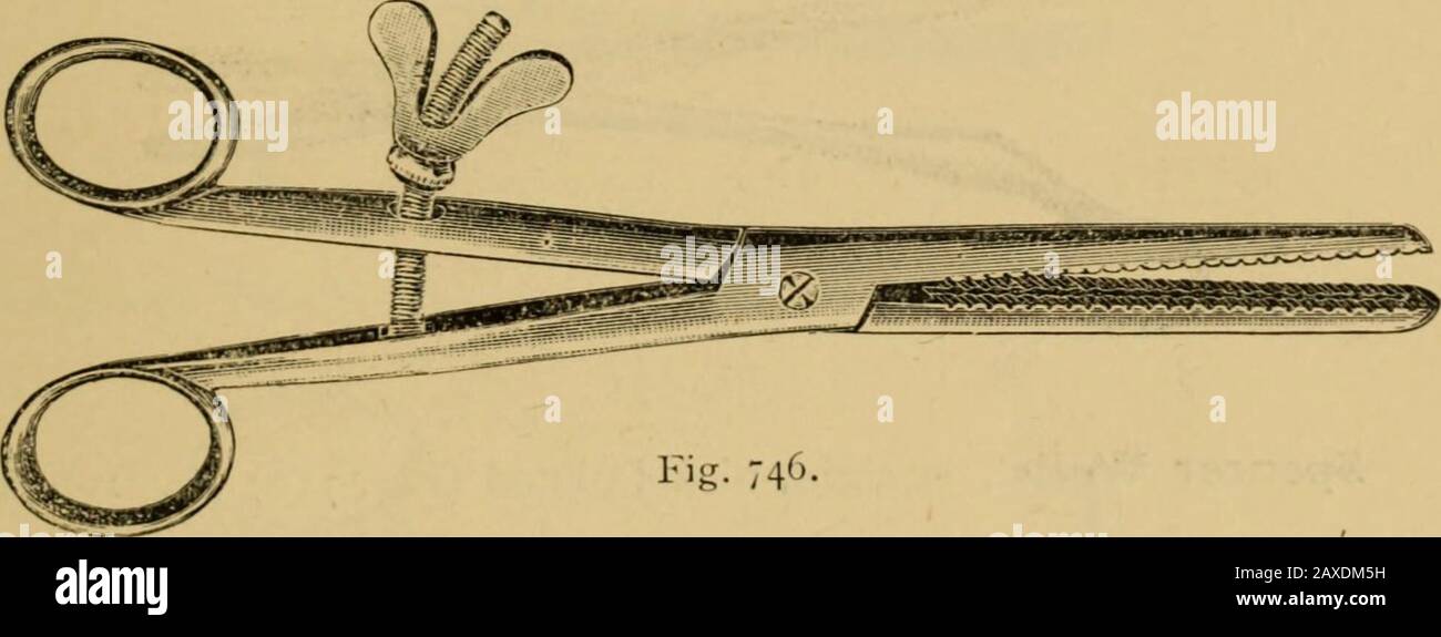 Catalogue of surgeons instruments and medical appliancesElectro-therapeutic apparatusSundries for the surgery and sick-room, medicine chests, etc . Fig. 745-Ascites Tube, Lawson Taits (Fig. 745) .. 10/6 each.Do. Spencer Wells 10/0 ,, Cautery Clamps, parallel +0/0 „ Cautery Irons 4/6 each. Do. do. set in case 14/6 per case. Chairs for Operations—Prices on application. ClampS, Nickel-plated— Lawson Taits • • 3°/° each- H Fig. 746- Spencer Wells (Fig. 746) 22/0 each. Drainage Tubes— » U- 747-Kceberles, -lass (Fig. 747) !/3 *ach- Fig. 74«. Keiths, glass (Fig. 748) 1/3 and 1 6 each. Soft Rubber »/o Stock Photo