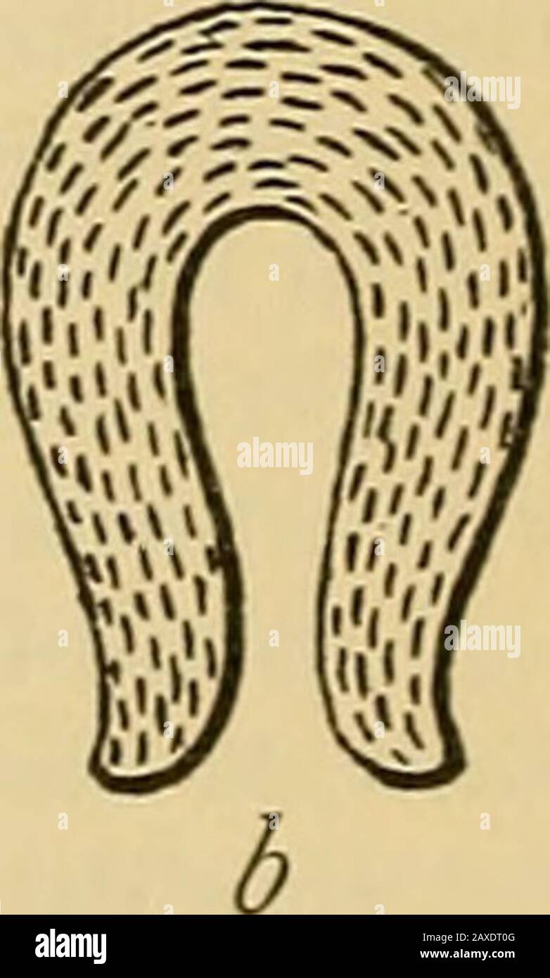 Uterine muscle hires stock photography and images Alamy