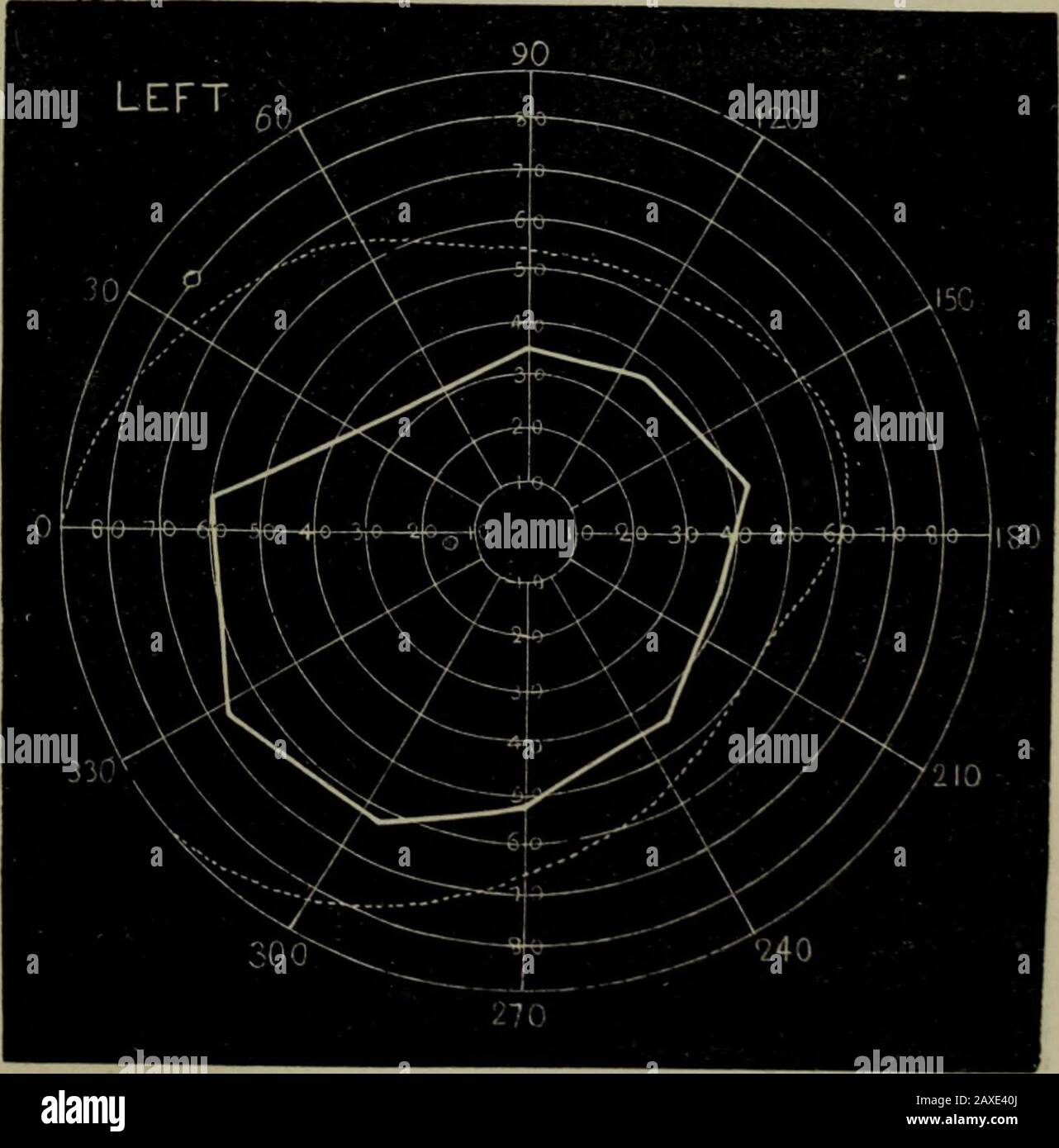 Transactions . The above charts were taken in daylight. 166 DISEASES OF ...