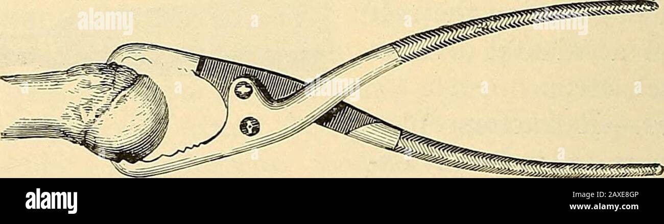 A manual of operative surgery . end uponthe taste and custom of the individual surgeon. The best for mostexcision operations is a simple straight narrow saw, with a movableback. In some instances, e.g. in certain excisions for ankylosis, a rat-tail or key-hole saw is needed. If it be considered needful to give a FIG. 452.—LANGENBECKS PERIOSTEAL ELEVATOR. curved surface to the free end of the bone, this may best be doneby means of a slender Butchers saw. French surgeons are for themost part in favour of the chain-saw, but that instrument has neverheld a prominent position with English operators Stock Photo