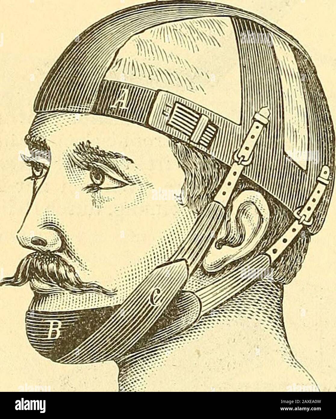 Nasenblutung hires stock photography and images