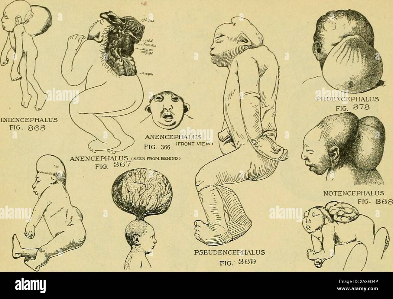 The practice of obstetrics, designed for the use of students and ...