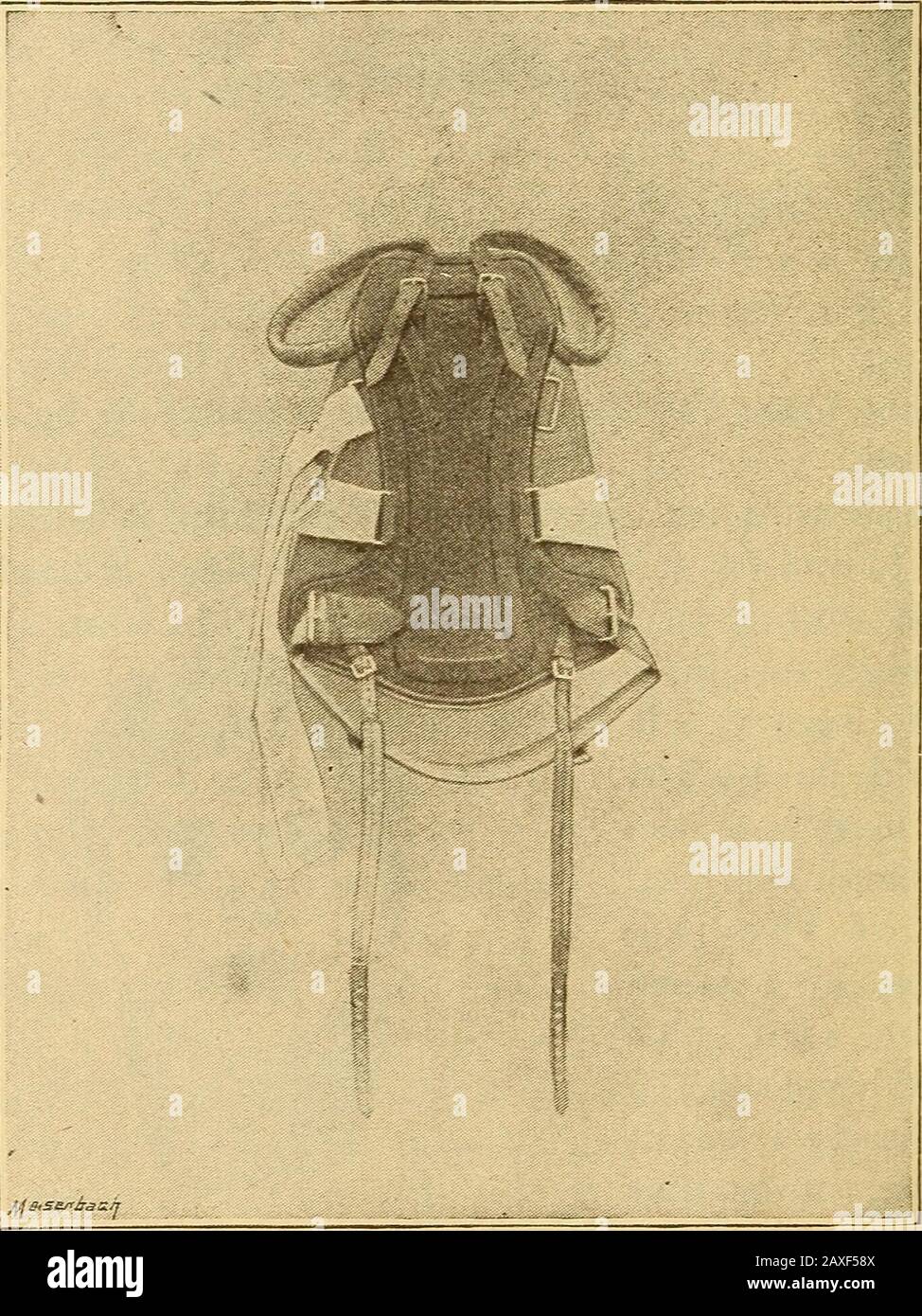 Lectures On Orthopedic Surgery 96 Lar For Use In Disease Of The Cervical Portion Of Thespine Is Made By Cutting From A Piece Of Sheet Metal Steel Iron Aluminum Zinc Or Tin A