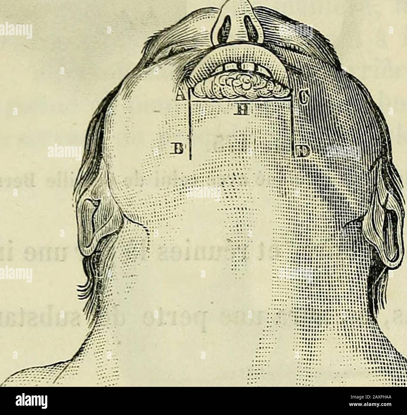 Page 14 - Opératoire High Resolution Stock Photography and ...