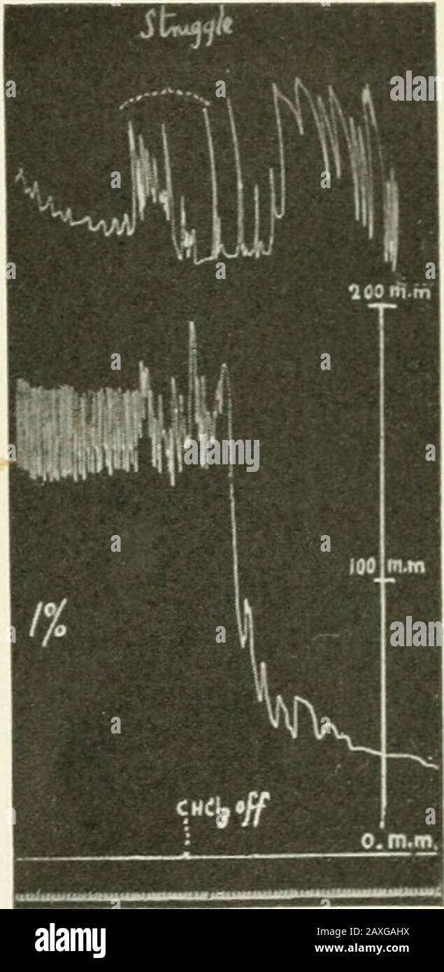 porte bicyclette pour voiture