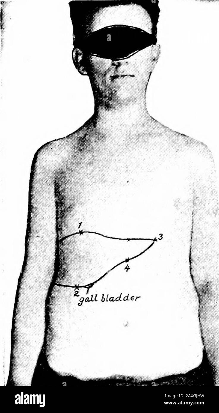 A manual of anatomy . amentumvenosum lies inthe fissure of that name ...