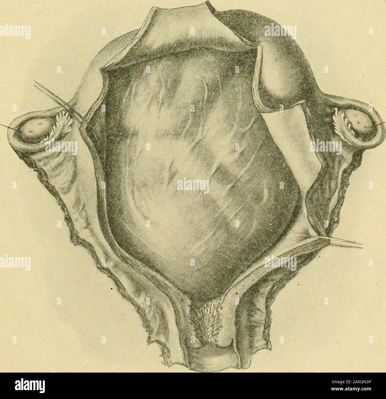 Uterus thickness hires stock photography and images Alamy
