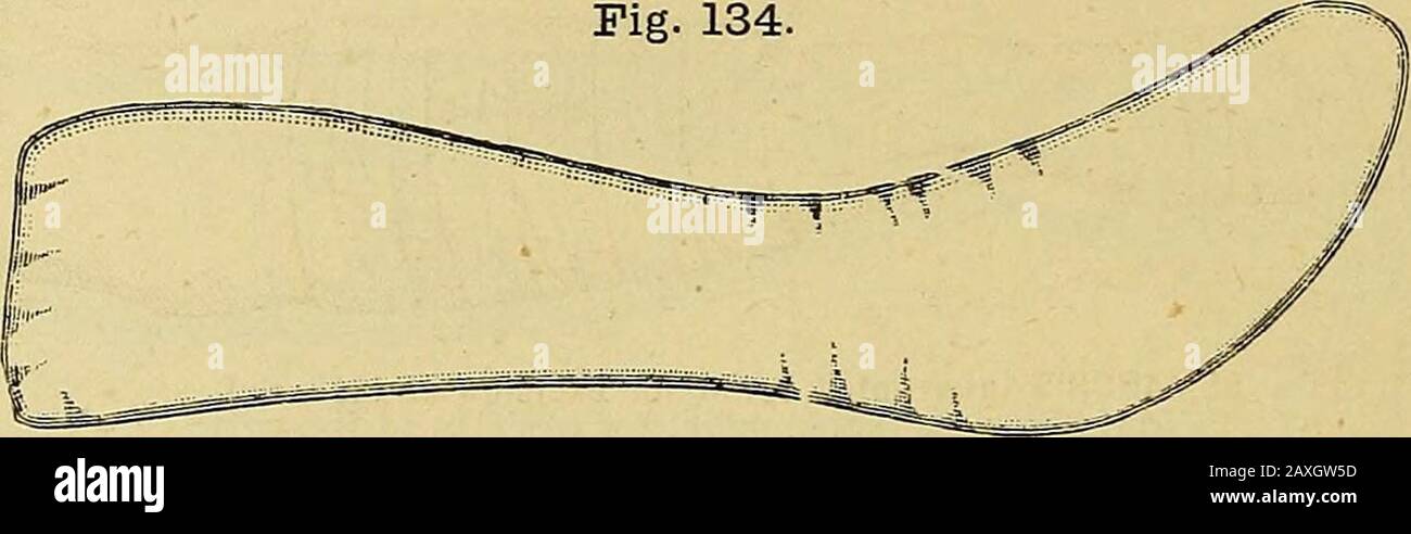 The surgeon's handbook on the treatment of wounded in war : a prize essay . LISTERS splintgfor excision of the wrist. fingers may rest with comfort, is especially suitable for the after-treat-ment, when frequent passive and active movements of the fingers haveto be undertaken. Esmarch, the Surgeons Handbook. r, 66 c. For Fractures of the forearm: a. StromeyerS padded adduction-splint, for fracture of the lowerend of the radius (fig. 134). Fig. 134.. STROMEYERS padded adduction splint for fracture of the lower end of the radius. [3. StromeyerS padded forearm splint, for simple and compoundfract Stock Photo