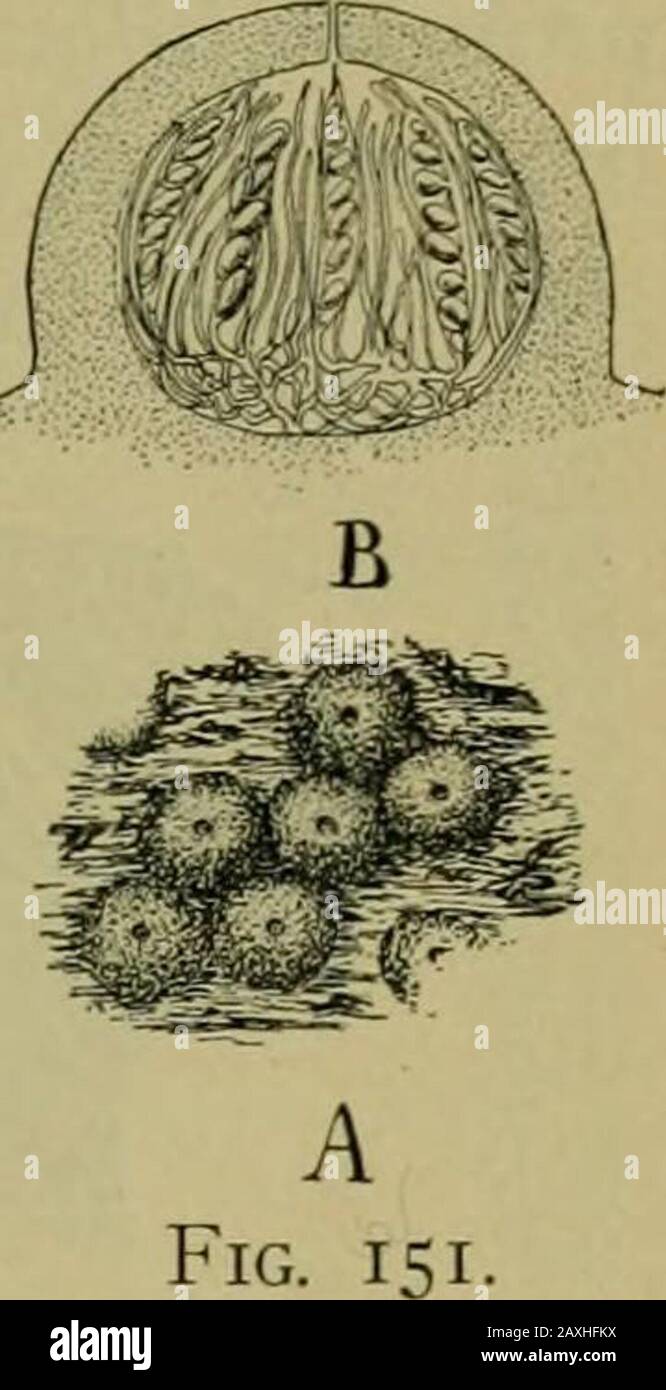 Nature and development of plants . Fig. 150. Fig. 149. A common black fungus, Hypoxylon: A, habit of the fungusas it appears on dead branches and logs. The round black bodies are anassociation of the mycelium, stroma, and numerous ascocarps. B, a singleascus enlarged, showing character of the ascospores. Fig. 150. The black knot, Ploivrightia, infecting a branch of cherry. Atthe bottom of the branch is shown the early summer or spore-bearingstage, c, and above a black warty mass of ascocarps, as, produced theprevious season. Fig. 151. A, several ascocarps enlarged, taken from region c in Fig.1 Stock Photo