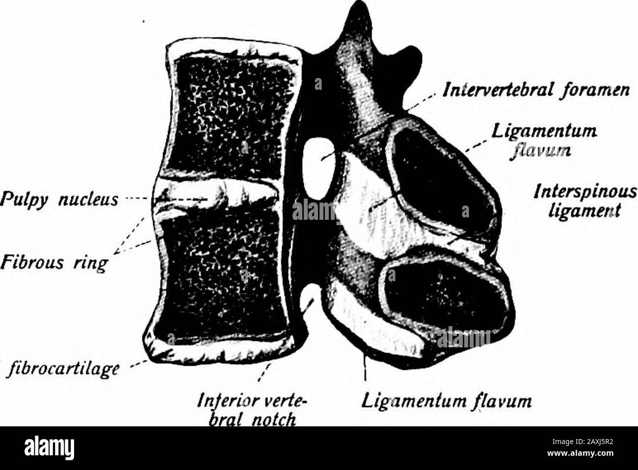 A manual of anatomy . Fig. 8o.—The ventral longitudinal lig-ament in the lower thoracic portion ofthe vertebral column, together with thecosto-vertebral ligaments seen from infront. {Sobotla and McMurrich.) Fig. 8i.—The dorsal longitudinal liga-ment in the lower thoracic and upperlumbar portions of the vertebral column.The vertebral arches have been removed.{Sobotta and McMurrich.) ,. Intervertebral foramen. Intervertebral fibrocartilage ? Ligamentum fla vam Fig. 82.—Two thoracic vertcbrze divided longitudinally in the median line and showing theligamenta flava. (Sobotta and McMurrich.) LIGAME Stock Photo