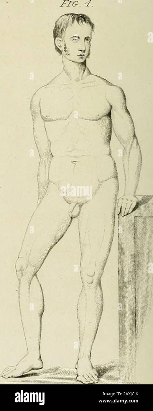A treatise on dislocations and on fractures of the joints . PLATE I. Shews the positions of the limb in the different dislocationsof the thigh-bone, and in the fracture of the cervix femoris. Fig. 1.The thigh-bone dislocated upwards, upon the dorsum iiii. The leg shorter; the hip projecting; the knee turned in-wards, and the patella at least two inches higher than theother. The foot turned inwards, and the toes resting upon themetatarsal bones of the other foot. The head of the bone isthrown back, and the trochanter major forwards. Fig. 2.The dislocation downwards in the foramen ovale. The leg Stock Photo