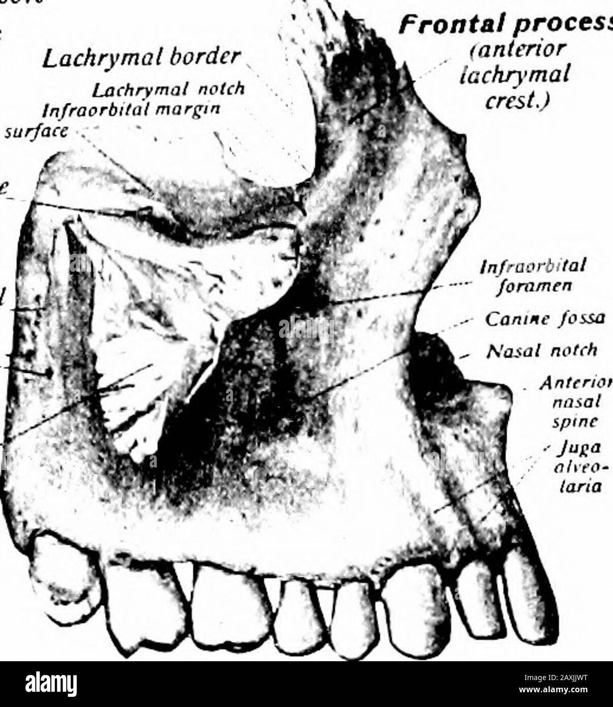A manual of anatomy . Incisive canal Maxillary sinus Pterygopalatine groovePa/ate process Lachrymal borderLachrymal notch Tuberosity orbital surfc of maxttlaInfraorbital groove  infratemporalsurfaceAlveolar foramina -•- Zygomatic process Frontal process (anterior lachrymal crest.). Fig. 38.—The right maxilla seen from themedial surface. {Sobotla and McMurrich.) Fig. 39.—The right maxilla seen fromthe lateral surface. {^Sobotta and Mc-Murrich.) that extends beyond the last molar tooth is called the maxillarytuberosity {tuber maxillare). The nasalj or medial surface (fades nasalis) forms a part Stock Photo