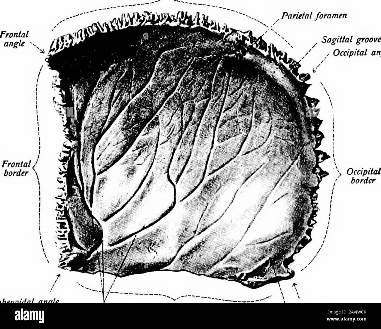 A Manual Of Anatomy Mastoid Angle Squamosal Border Sagittal Border Sphenoidalanglefig 22 Parietal Foramen Sagittal Groove Occipital Angle Frontal Border Sphenoidal Angle Sulci Arteriosl Squamosal Border Mastoid Angle Fig 23 Sigmoid